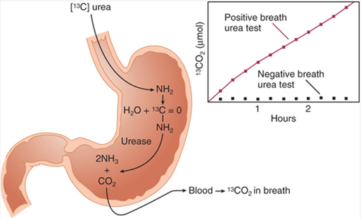 How The Urea Breath Test Works Medicine Specifics