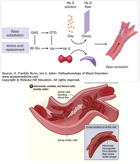 Is Sickle Cell Anemia A Sex Linked Trait Naked Photo