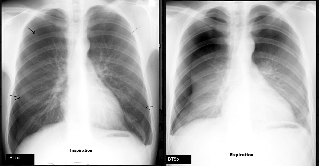 respirology-icu-medicine-specifics-page-3