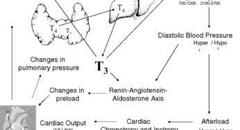 Diastolic Hypertension in Hypothyroidism: Mechanism