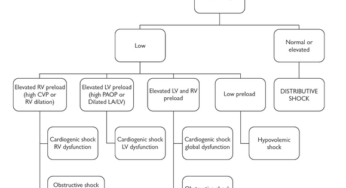Pulmonary Embolism causing Obstructive Shock: Mechanism