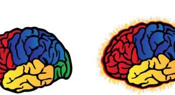 Why Steroids before Antibiotics in Bacterial Meningitis?